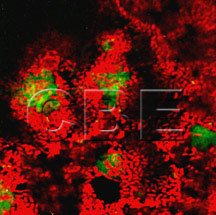 Klebsiella pneumoniae Klebsiella pneumoniae